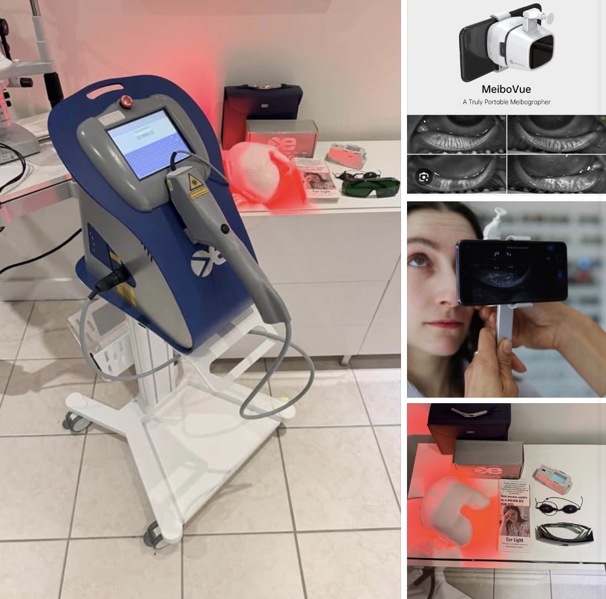 Axis medical EyeLight (IPL+LLLT)
